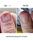 NAILSOFTHEDAY ONISTOP – regenerating oil against onycholysis, 15 ml