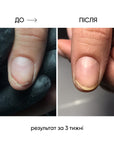 NAILSOFTHEDAY ONISTOP – regenerating oil against onycholysis, 15 ml