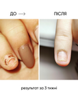 NAILSOFTHEDAY ONISTOP – regenerating oil against onycholysis, 15 ml