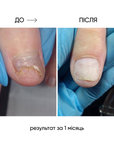 NAILSOFTHEDAY ONISTOP – regenerating oil against onycholysis, 15 ml