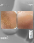Resultum Regenerix – cream against cracks for hands and feet, 50 ml