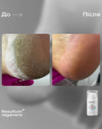 Resultum Regenerix – cream against cracks for hands and feet, 25 ml