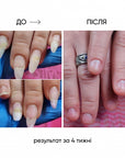 NAILSOFTHEDAY ONISTOP – regenerating oil against onycholysis, 8 ml