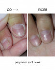 NAILSOFTHEDAY ONISTOP – regenerating oil against onycholysis, 8 ml